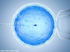 42岁二胎案例